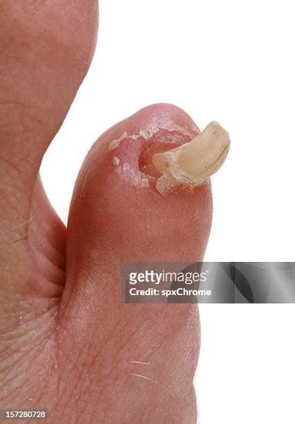 gross feet pictures|7,000+ Gross Feet Stock Photos, Pictures & Royalty。